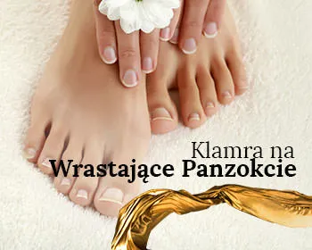 Klamra na wrastające paznokcie