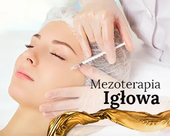 Mezoterapia igłowa
